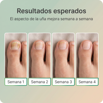 Sérum Reparador De Uñas Y Cutículas Repara - fortalece - nutre