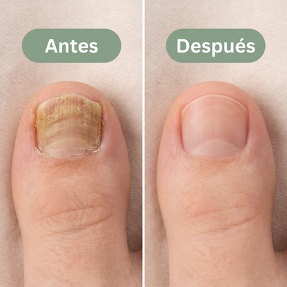 Sérum Reparador De Uñas Y Cutículas Repara - fortalece - nutre